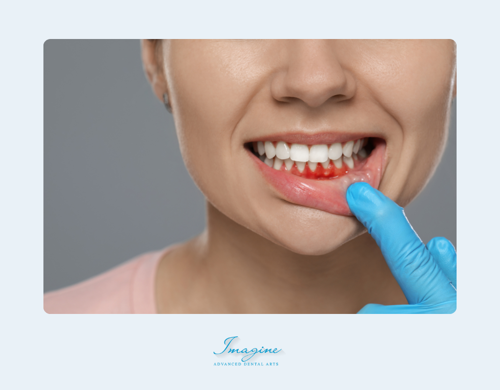 When to Get Gum Disease Treatment?