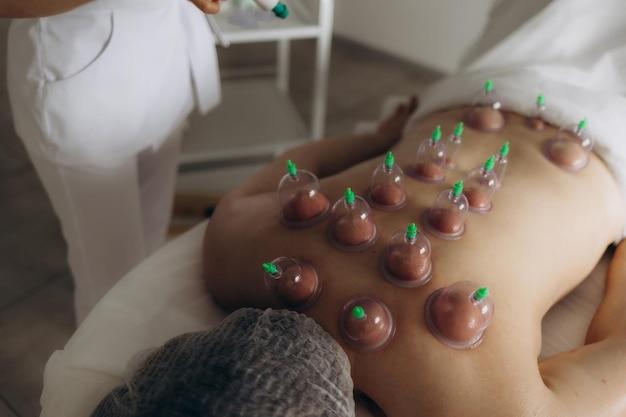 Massage vacuum cups Closeup of a man lying with cans on his back in a spa Vacuum jars in treatment and cosmetology Vacuum therapy Cup massage selective focus