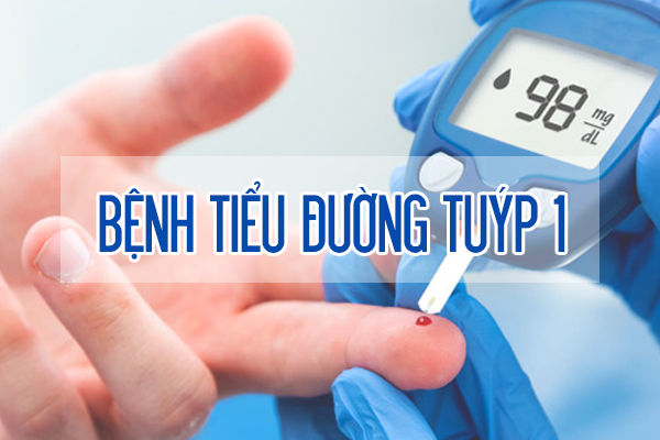 Tiểu đường type 1 là một bệnh lý tự miễn hoàn toàn có thể ổn định được chỉ số đường huyết