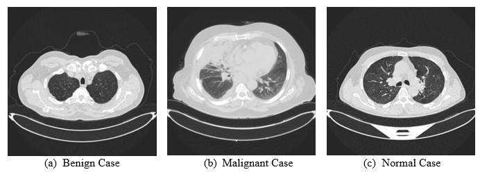 A close-up of a ct scan

Description automatically generated