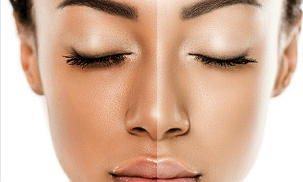 Niacinamide Serumyuyuiy