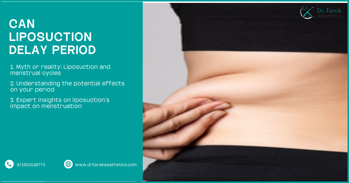 Can Liposuction Delay Period