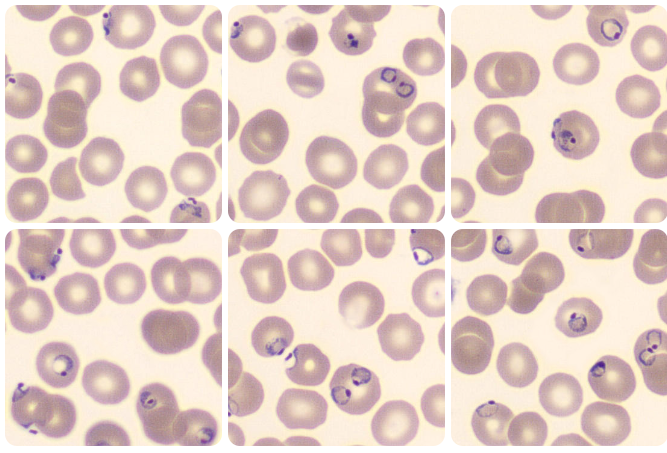 hemoparasitoses