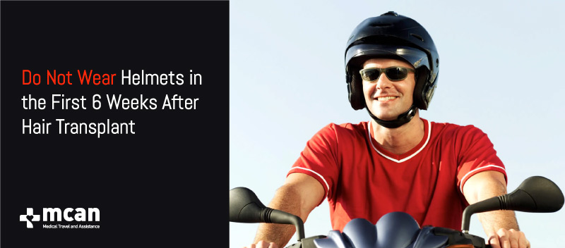 Do not wear heavy hats like helmet after hair transplant