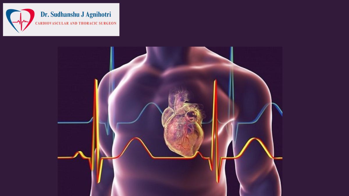 Heart Surgery - Dr Sudhanshu J Agnihotri - Cardiologist in Indore - Indore MP