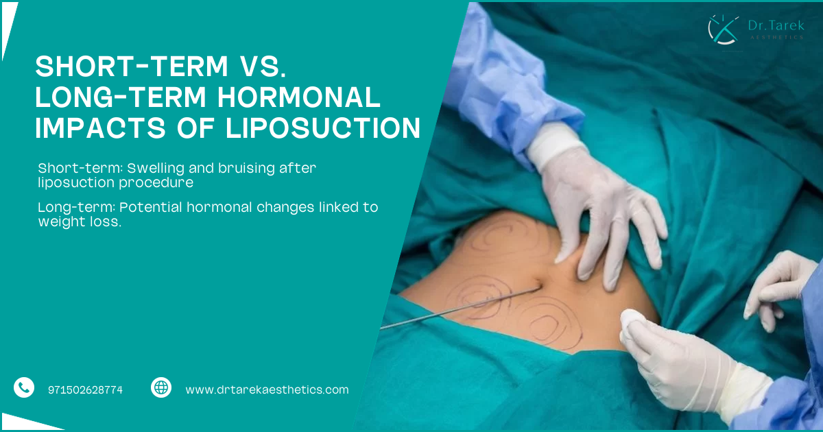 Does Liposuction Affect Hormones