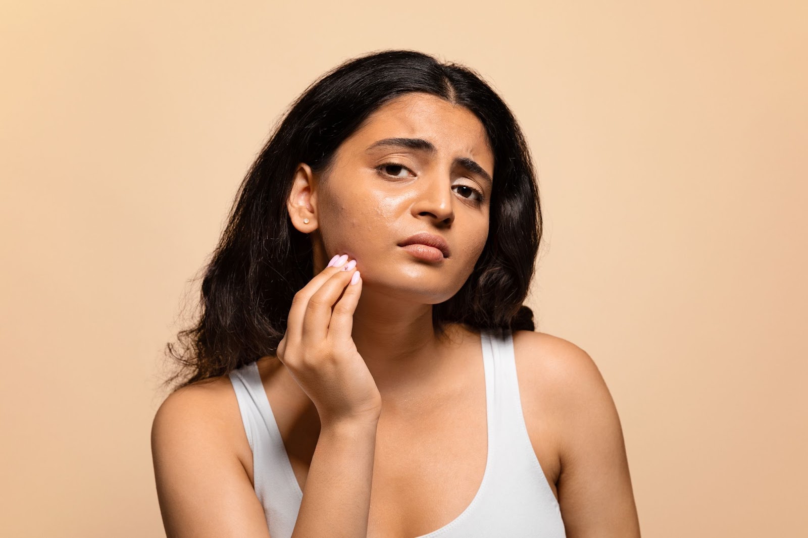 What Causes Oily Skin