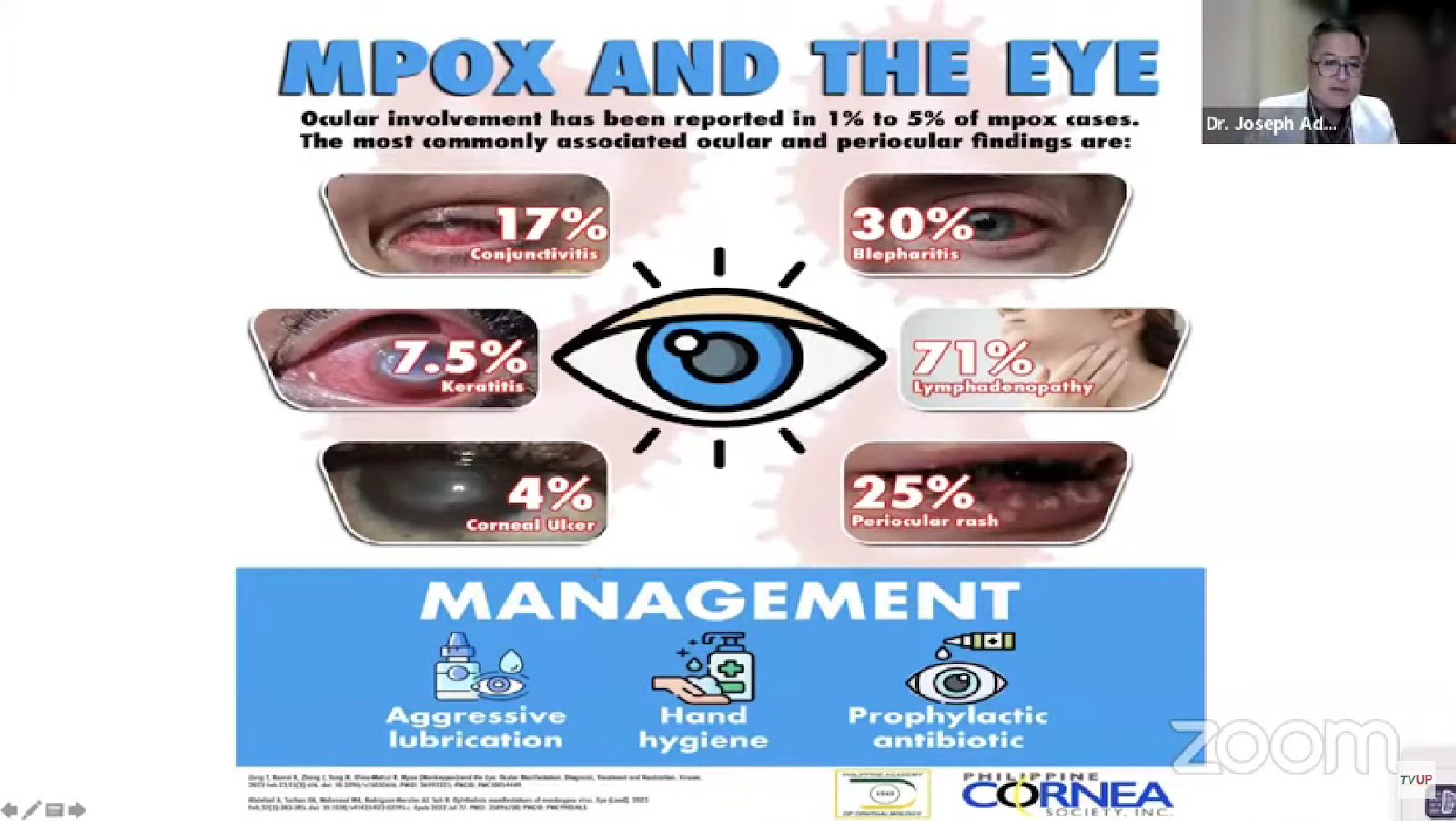 A poster of eye diseases

Description automatically generated with medium confidence