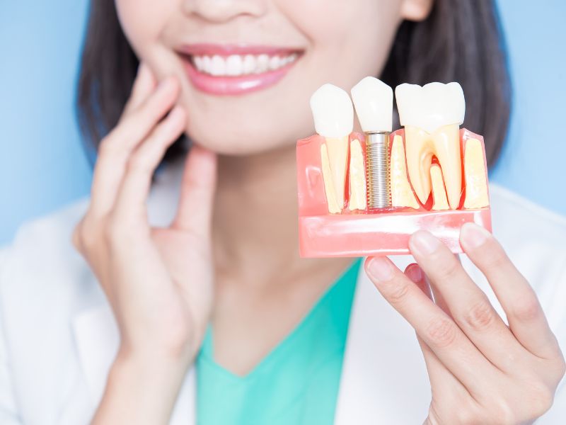 quanto custa um implante dentário tipos