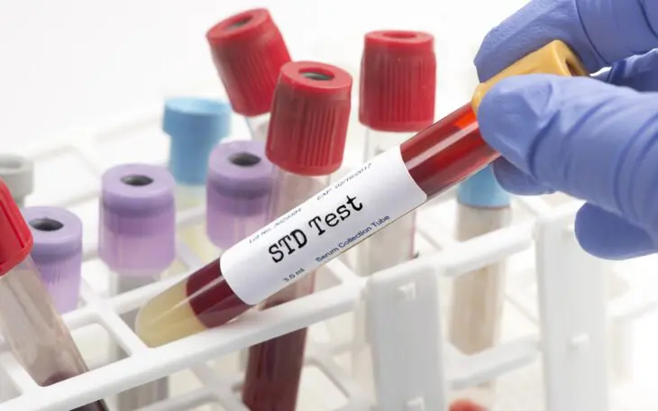 STD Testing Coupons 2024: How to Save on Your Screening
