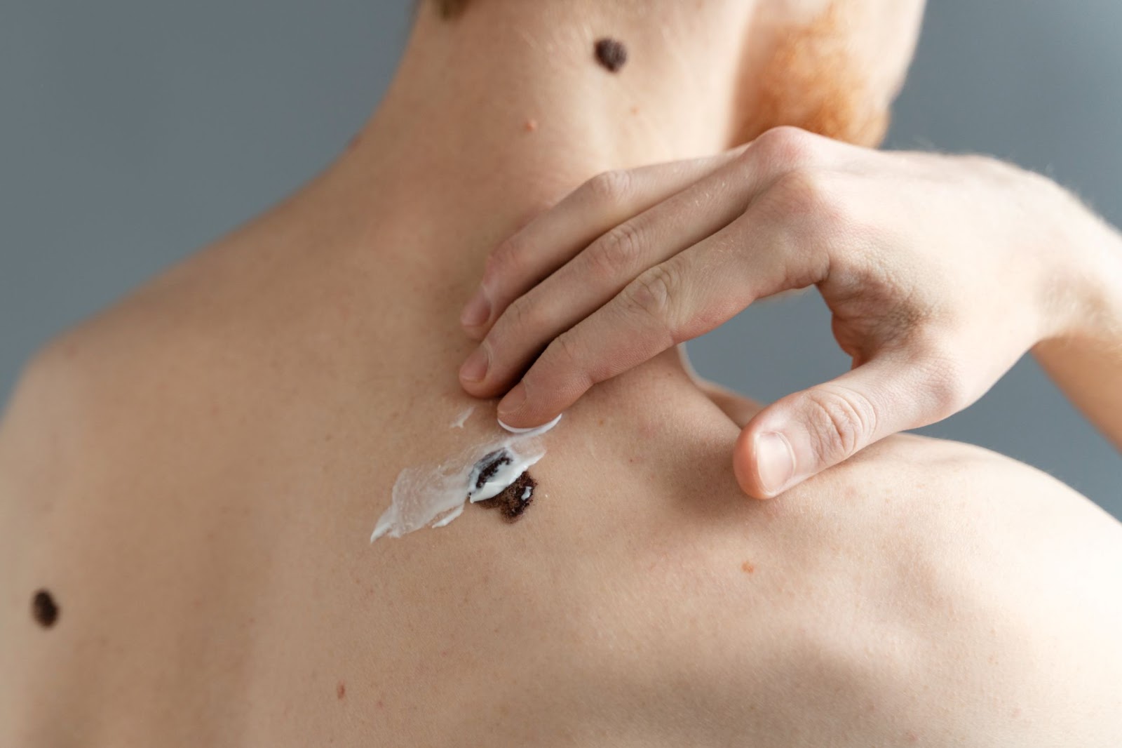 how to remove skin tags in one night