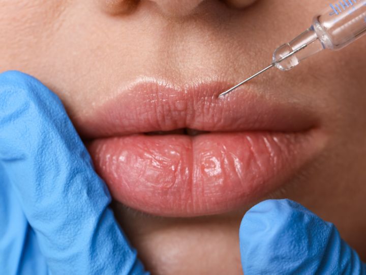 Person receiving filler care in lips