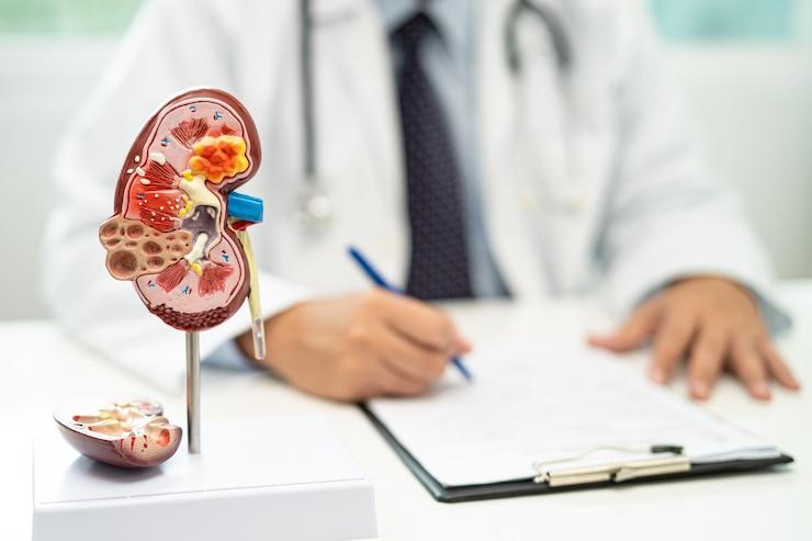 Kidney disease Chronic kidney disease ckd Doctor with human model to study and treat in hospital