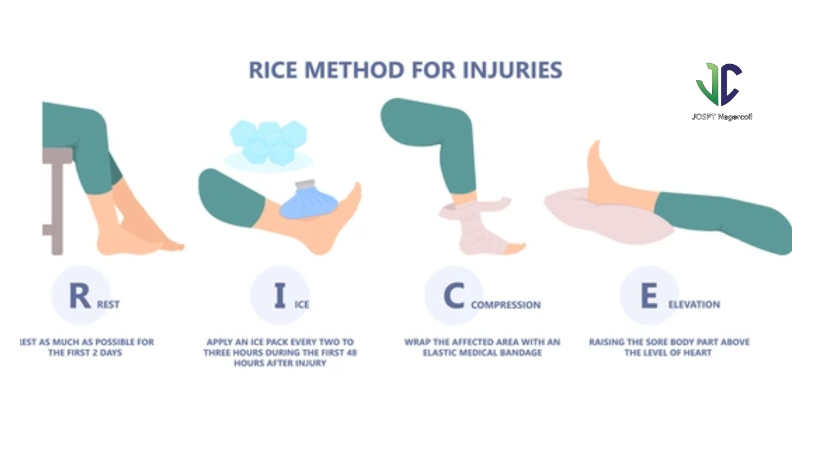 Steps of RICE method for ankle sprain – Rest, Ice, Compression, and Elevation shown with simple visuals.
