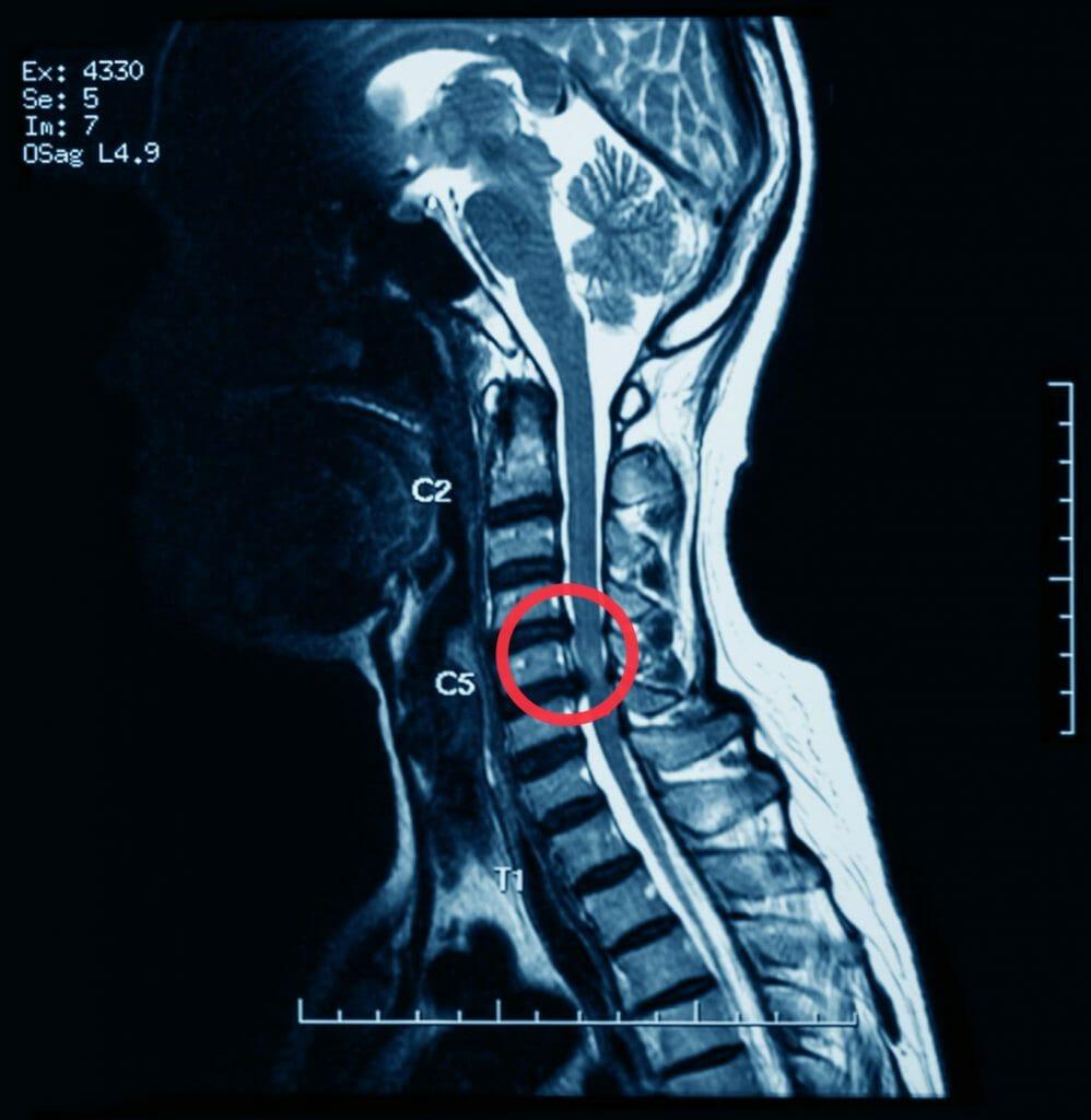 A close-up of a mri scan

Description automatically generated