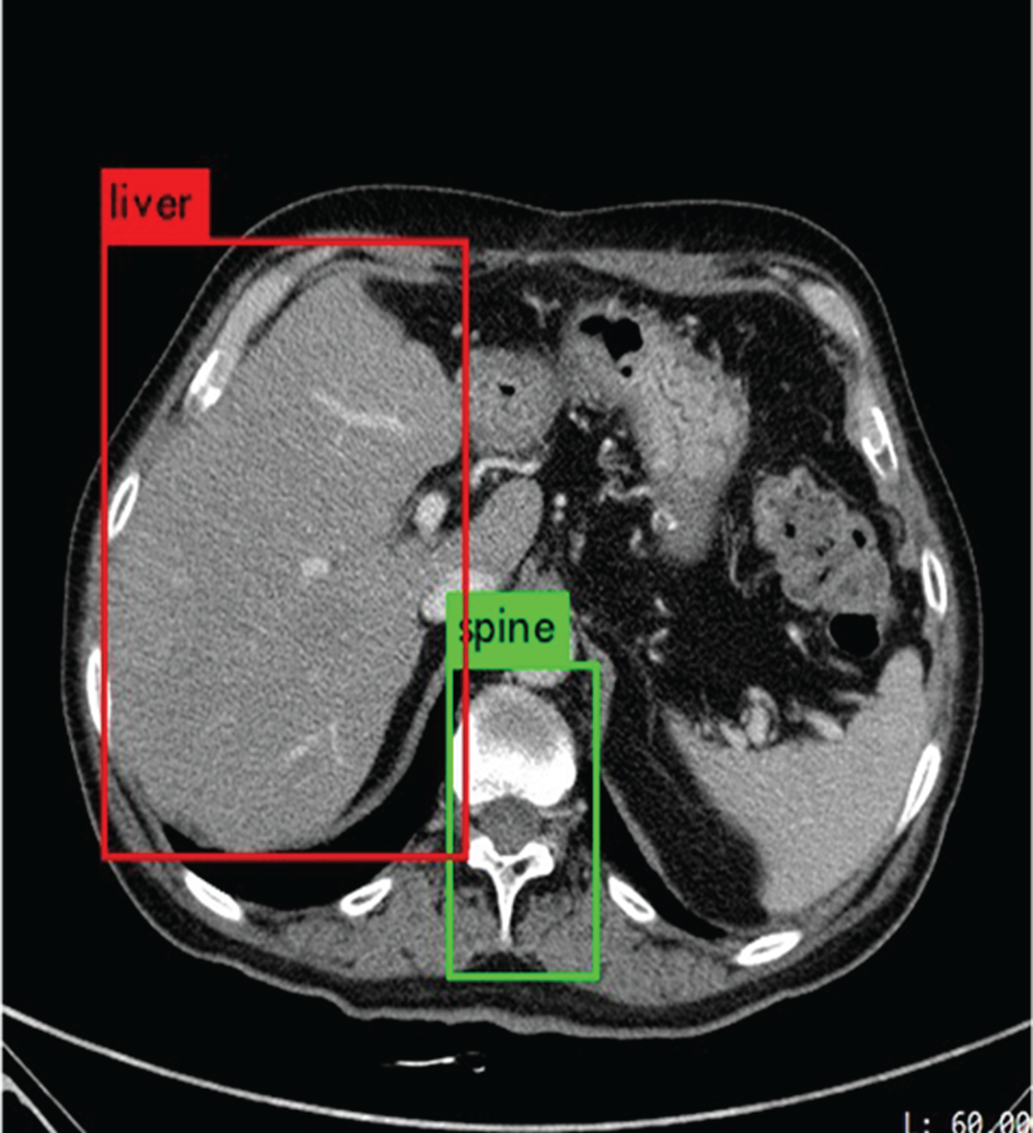Medical Imaging