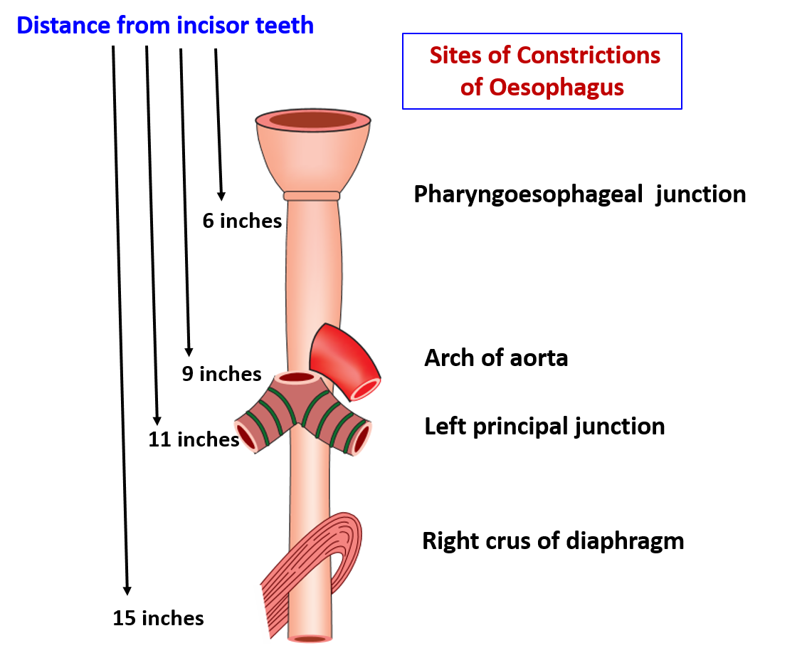 constrictions of oesophagus