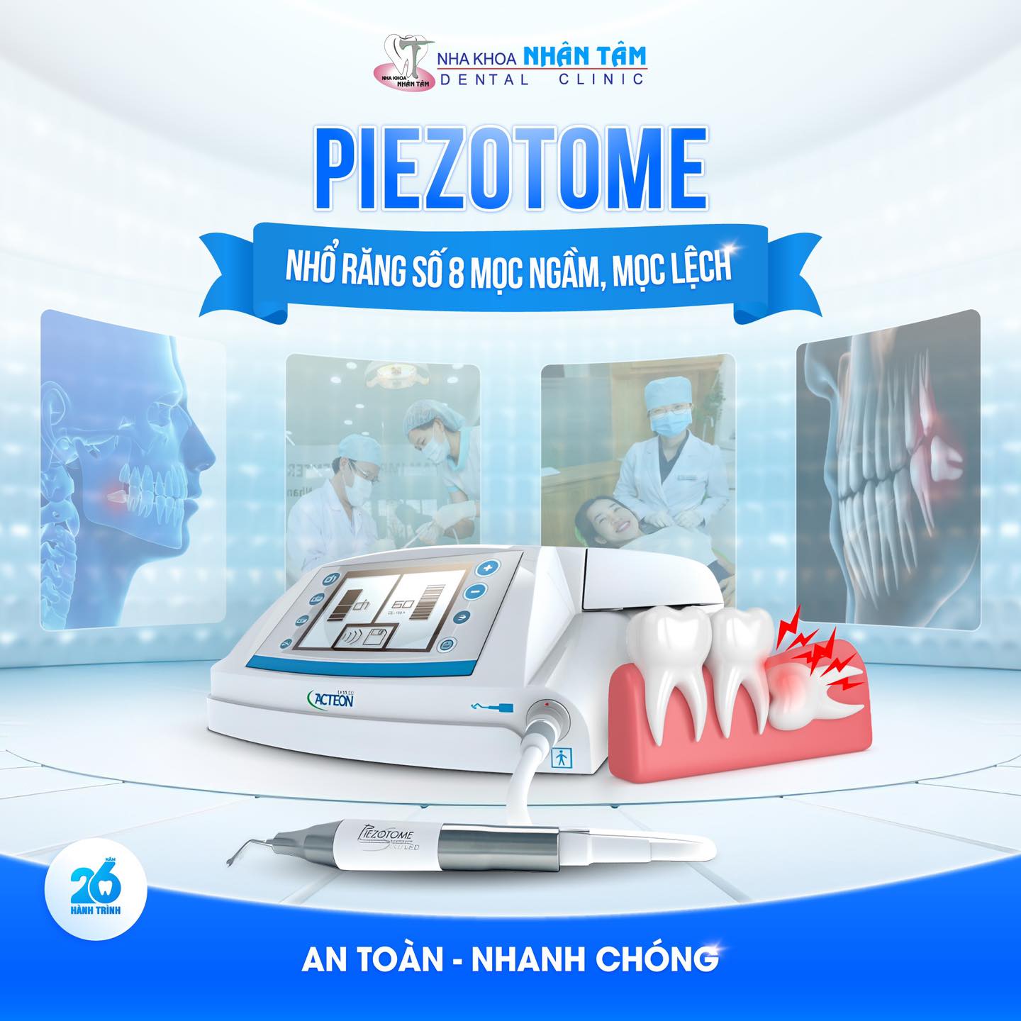 6 lý do phải nhổ răng khôn càng sớm càng tốt