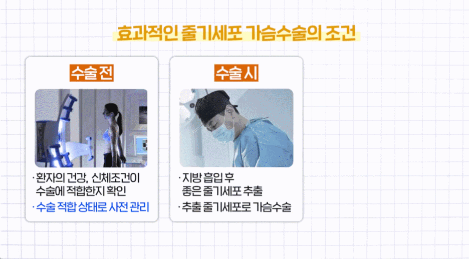 가슴수술의_조건.gif