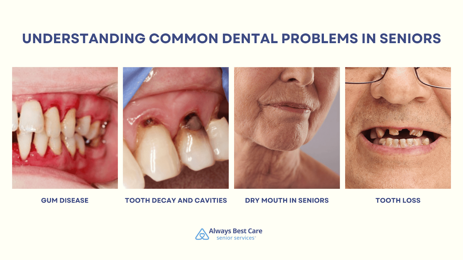 This is an infographic detailing the most common dental problems in seniors