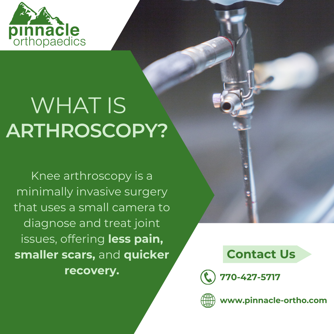 What to Expect from Knee Arthroscopy