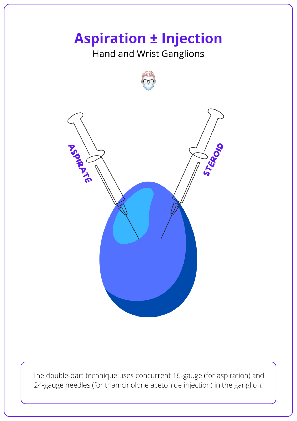 Visualised the double dart technique in managing ganglion cysts. 