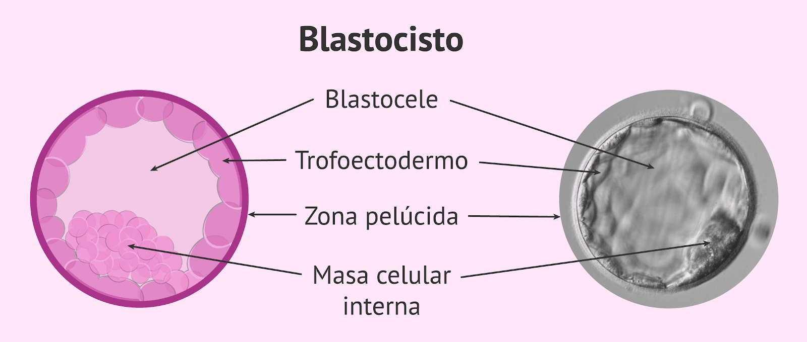 Embrión en estadio de blastocisto