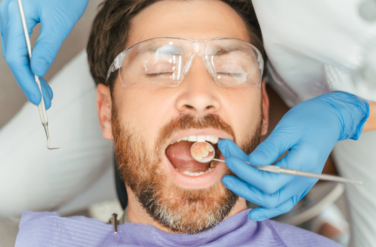 An overhead view of a patient lying down during a dental exam while an out-of-frame dentist checks the state of their dental fillings