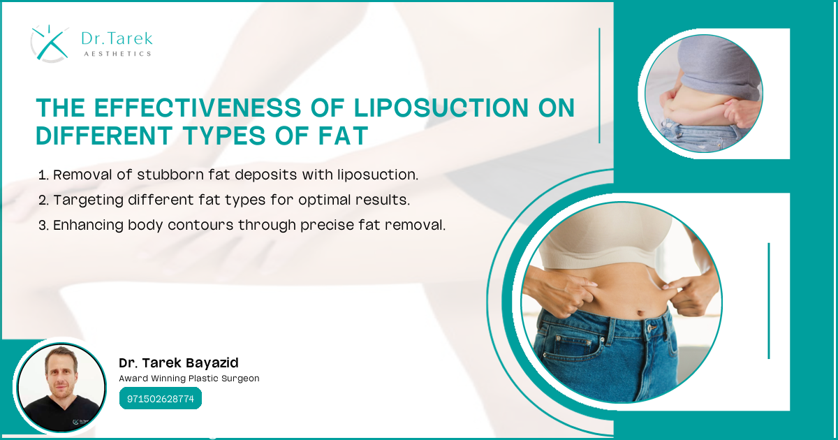 Can Liposuction Get Rid Of Visceral Fat