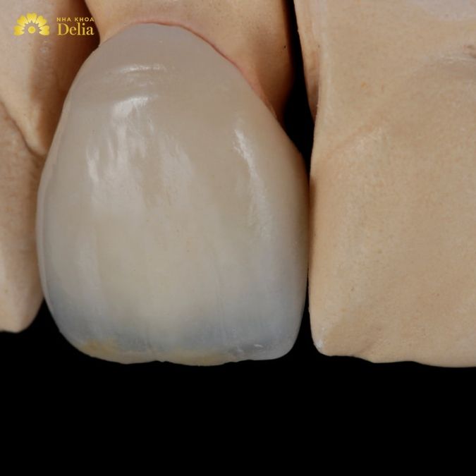 Phân loại răng sứ Zirconia theo chức năng