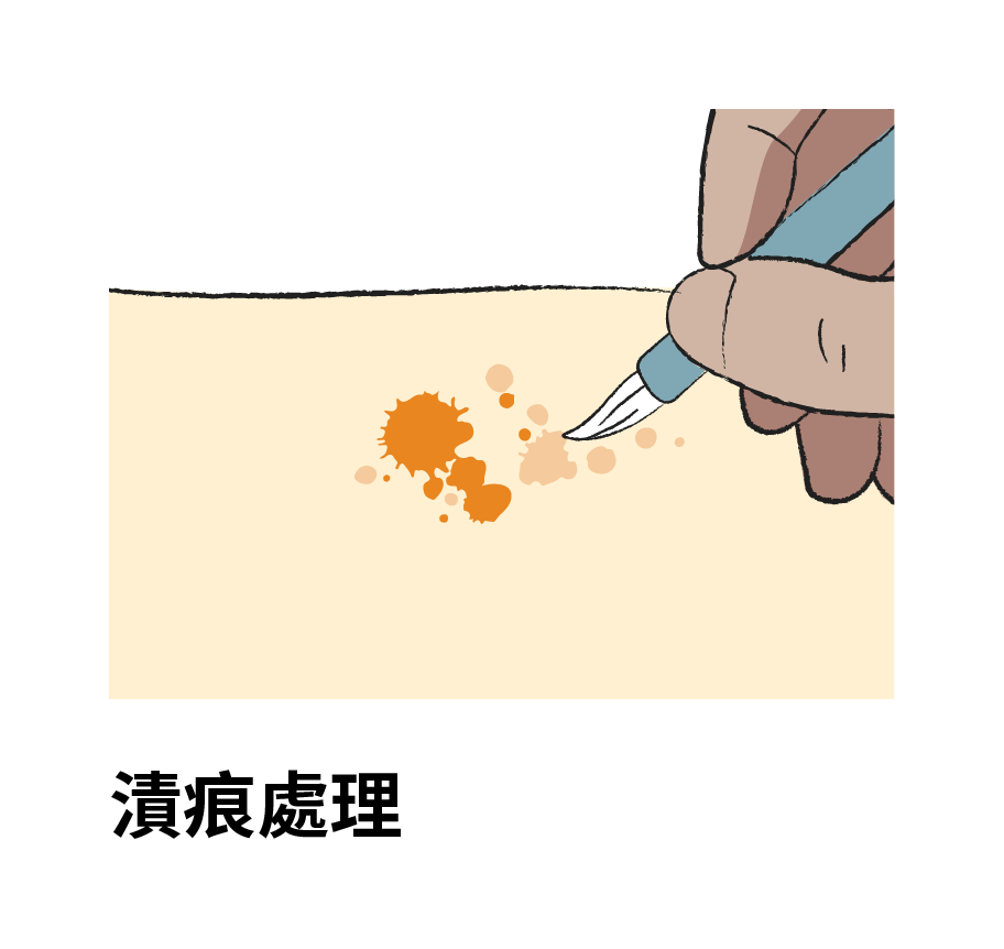 漬痕處理：書頁上的水漬、咖啡漬和油漬等漬痕可使用水彩筆沾水或溶劑來模糊邊緣，逐步降低漬痕的形狀，使其變得不明顯，但須進能避免產生新的水痕。如有突起附著物，可以用手術刀慢慢剃除。如有較為明顯的漬痕需對紙長進行水洗作業。