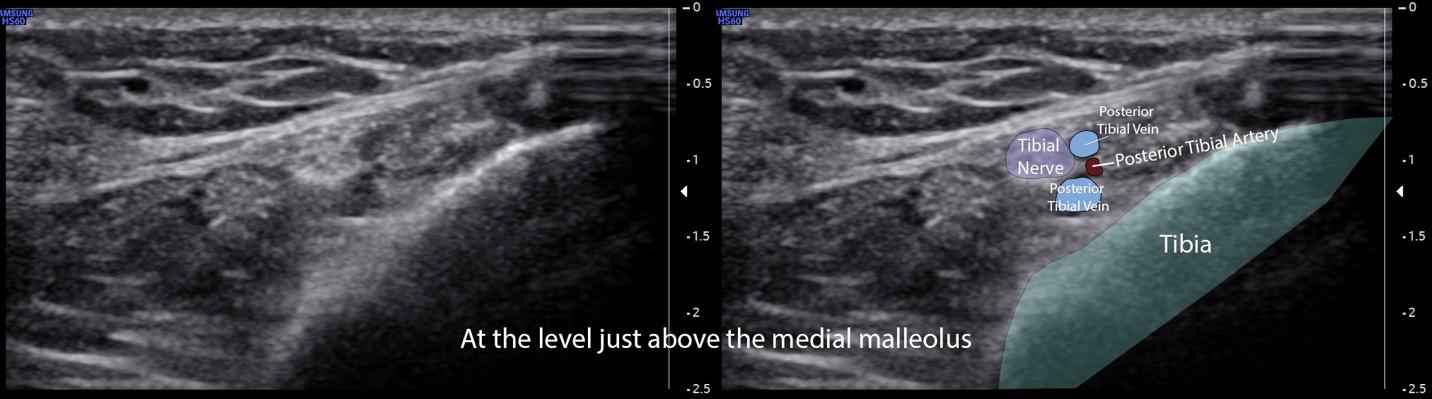 A close-up of ultrasound images

Description automatically generated