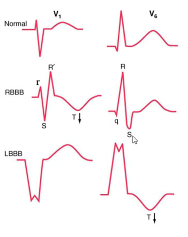 A diagram of a normal heart rate

Description automatically generated with medium confidence