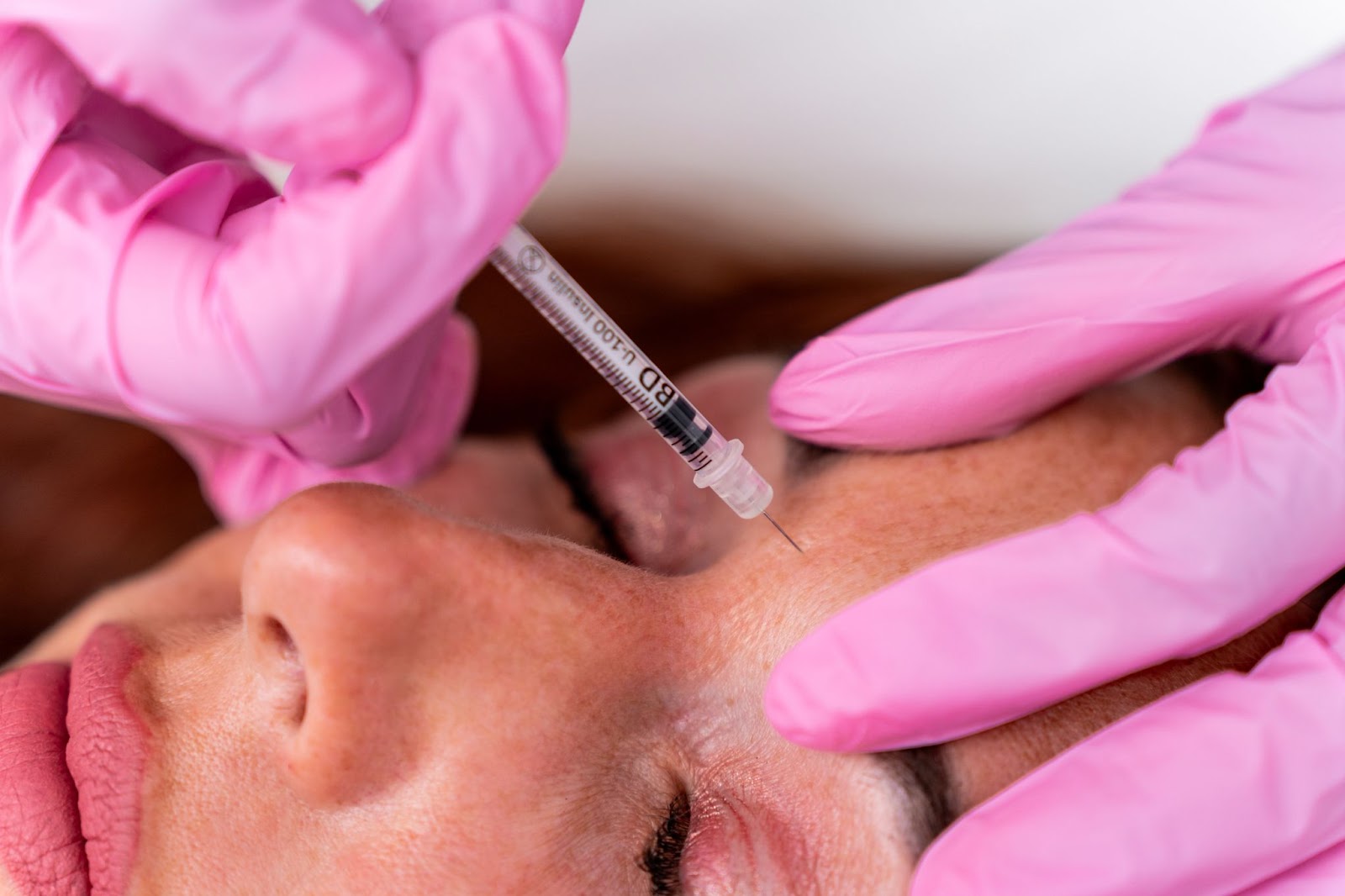 Botox treatment at Fillerhouse 