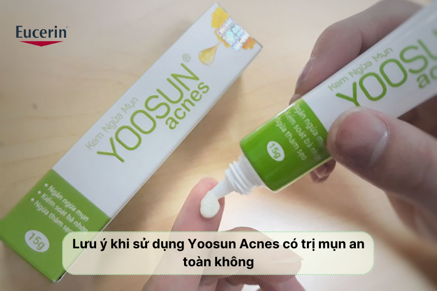 Lưu ý khi sử dụng Yoosun Acnes có trị mụn an toàn không