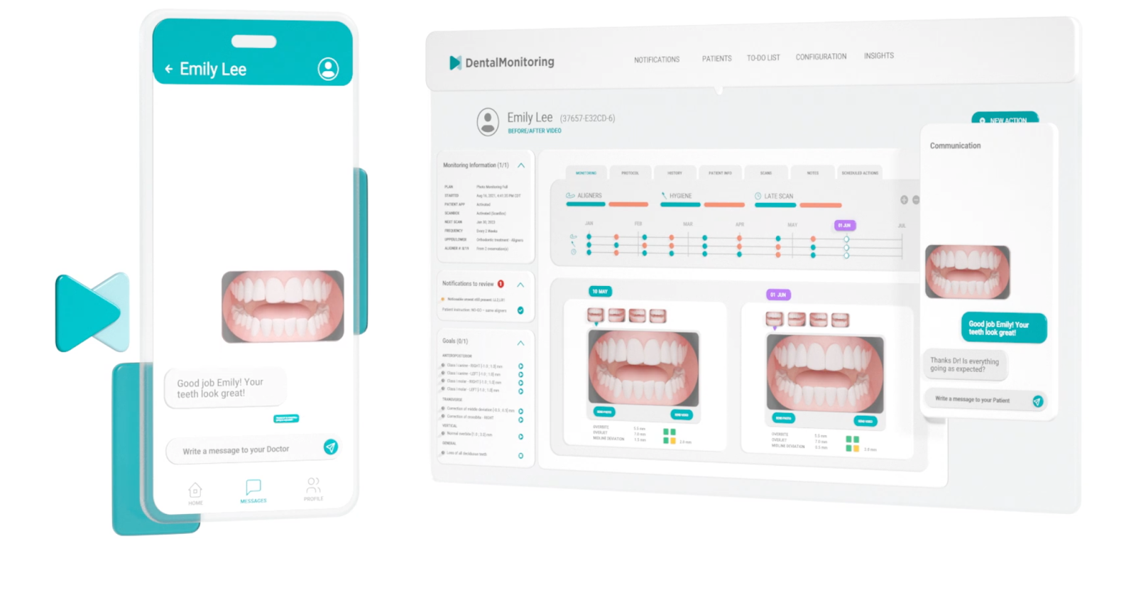 Dental Monitoring