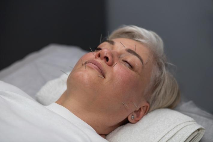 A person lying down with needles on her face

Description automatically generated