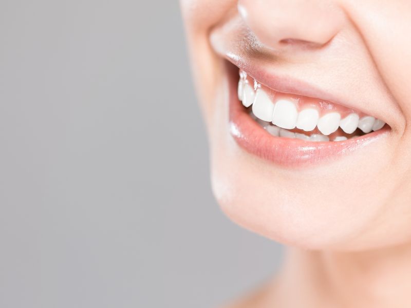 clareamento dental a laser cuidados