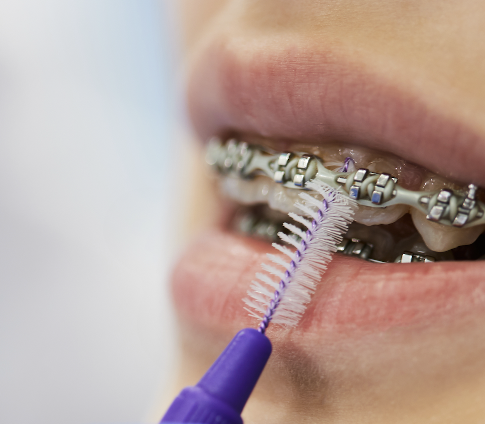 Oral Care