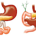 Understanding the Whipple Procedure: Step-by-Step Surgical Overview