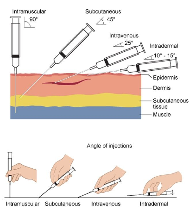 Key Facts on Administering Injections