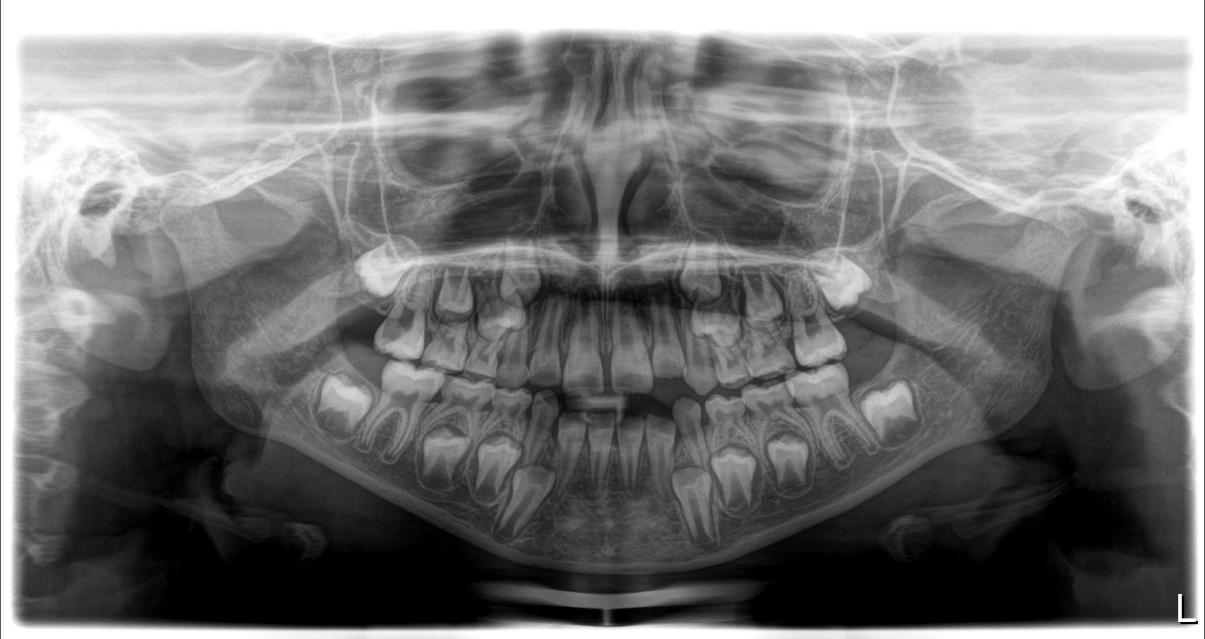 RADIOGRAFIA PANORAMICA - 0-2.jpg