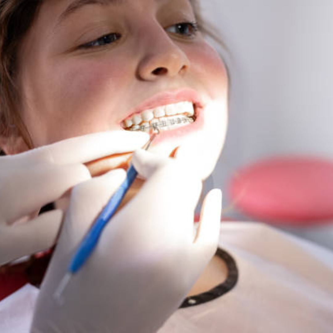 Discover the Best Orthodontists for Your Perfect Smile