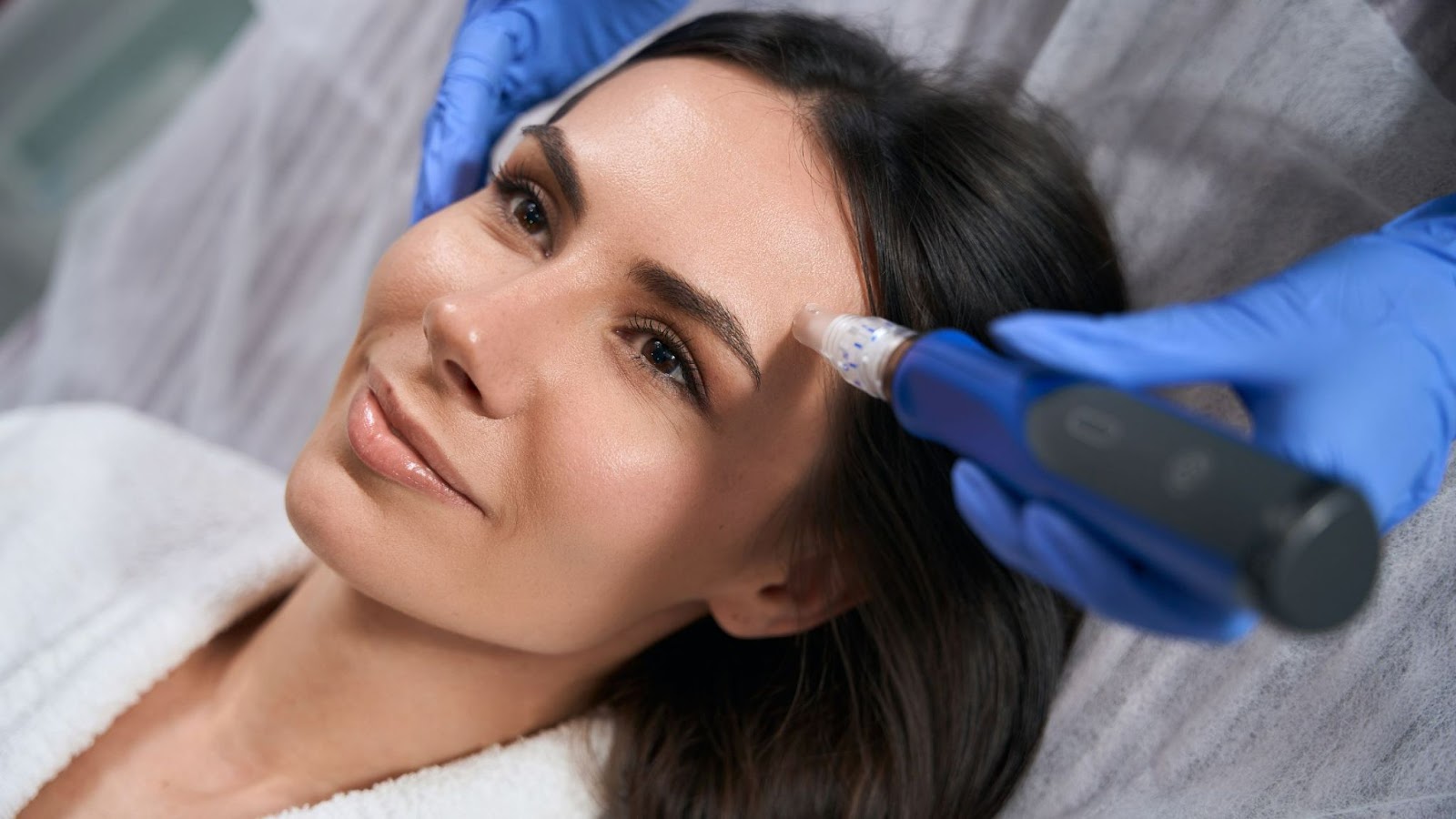 microneedling for normal skin