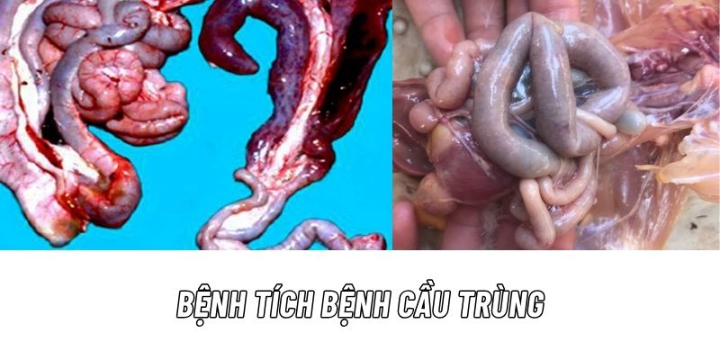 Bệnh tích cầu trùng ở gà tại ruột non và manh tràng