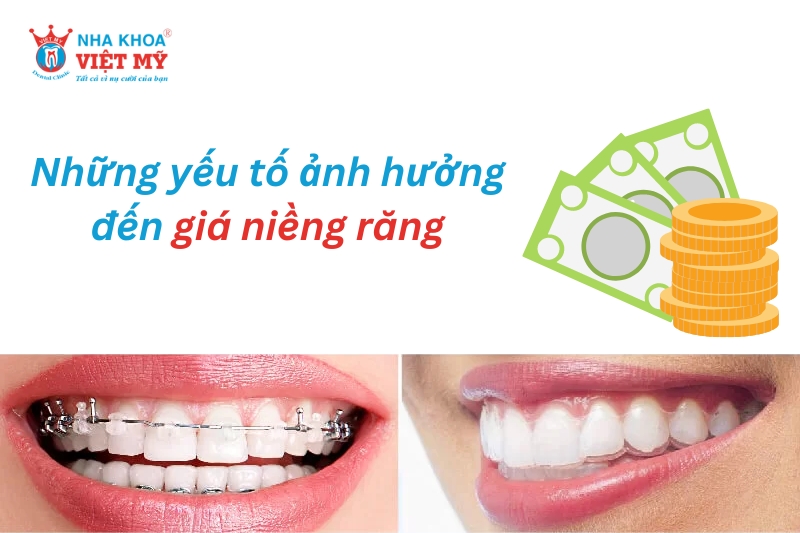 những yếu tố ảnh hưởng đến chi phí niềng răng