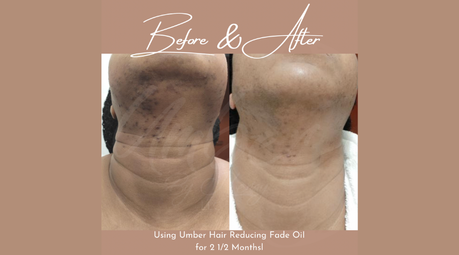 woman's results from hair reducing fade oil