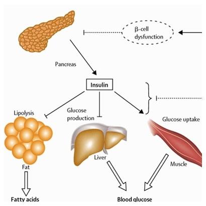 What is Insulin?