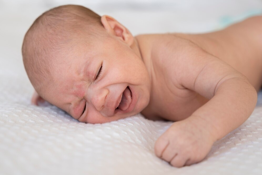 Baby with acne