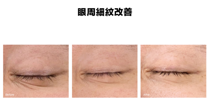 一張含有 皮膚, 管風琴, 特寫, 睫毛 的圖片

AI 產生的內容可能不正確。